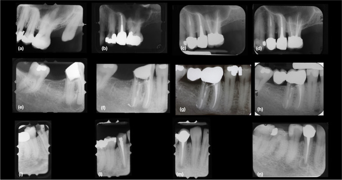 Fig. 1 