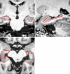 Fig. 4