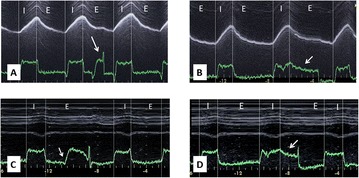 Fig. 1