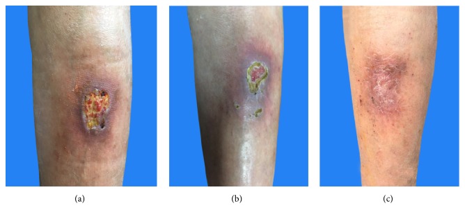 Figure 2