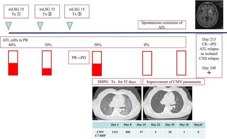 Fig. 1B