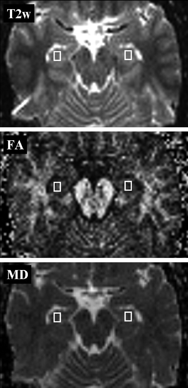 Fig 1.