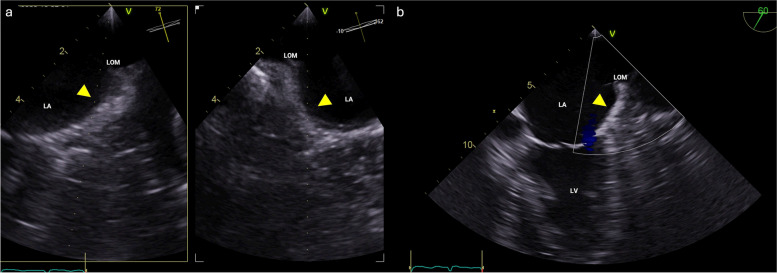 Fig. 1