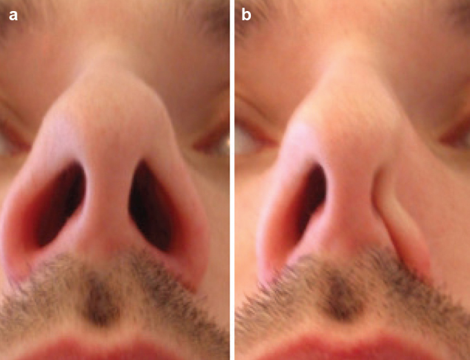 FIG. 2. a, b.