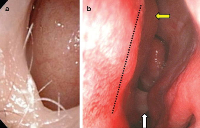 FIG. 10. a, b.