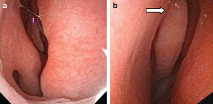 FIG. 6. a, b.