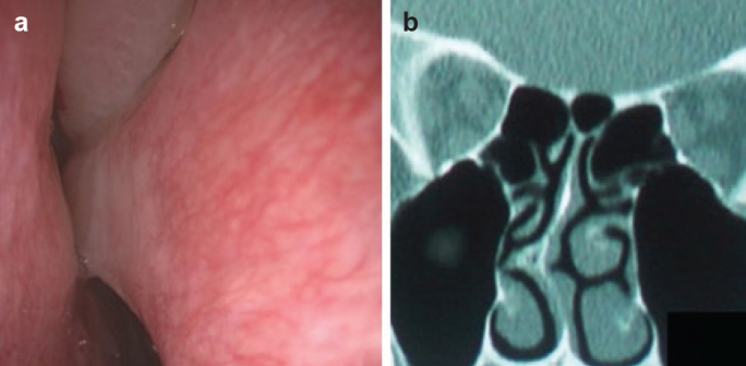 FIG. 7. a, b.