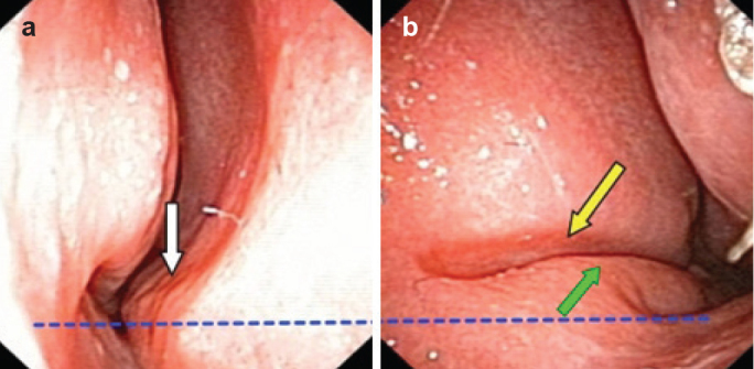 FIG. 8. a, b.