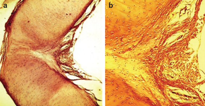 FIG. 11. a, b.