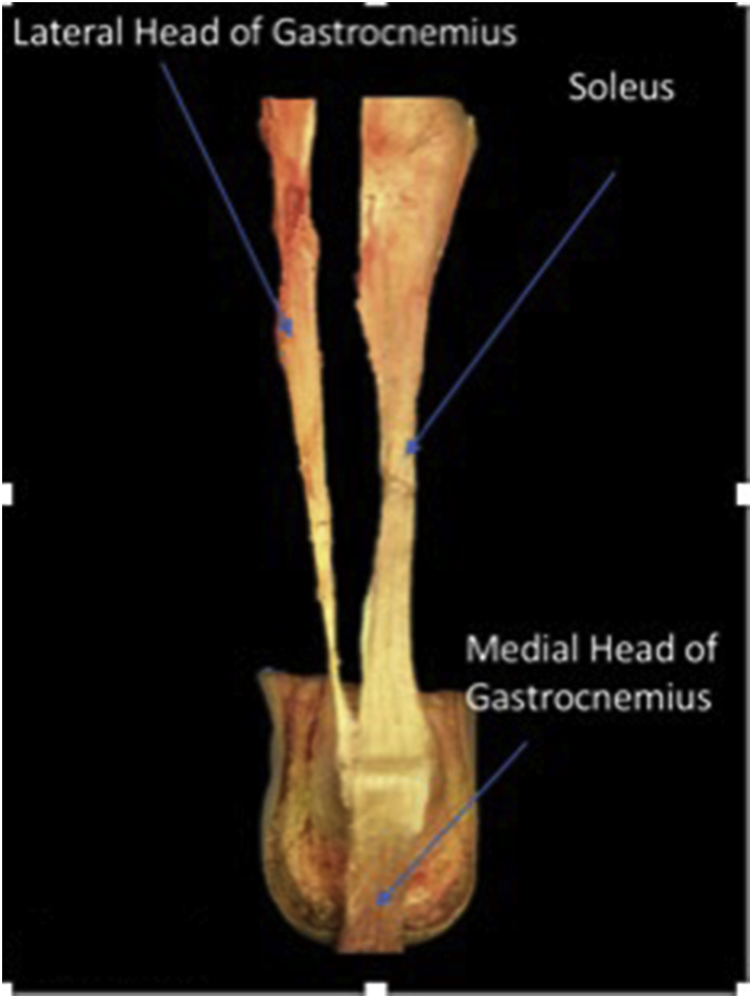 Fig. 3