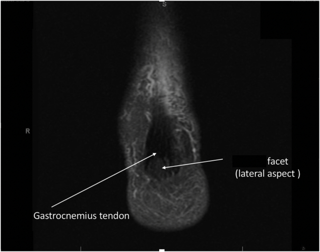 Fig. 10