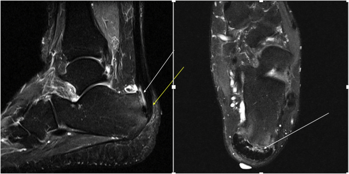 Fig. 12