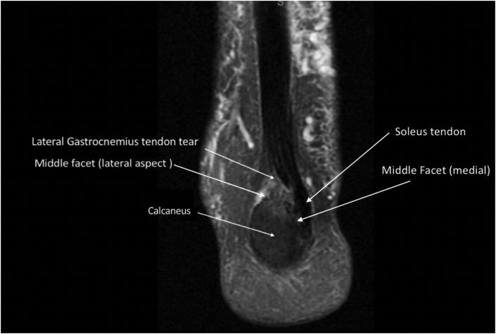 Fig. 11