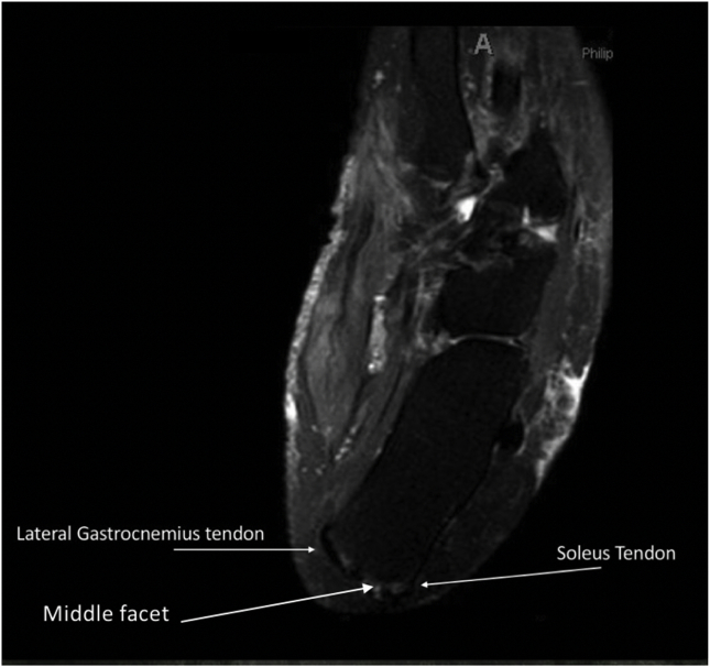 Fig. 9