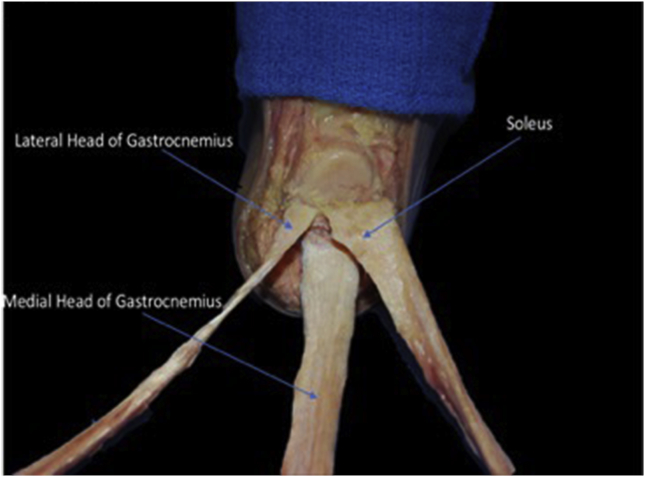 Fig. 2