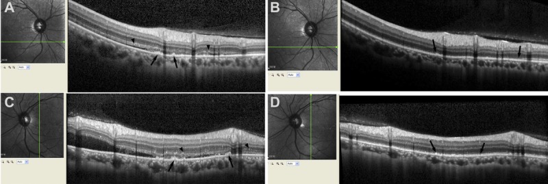 FIGURE 3