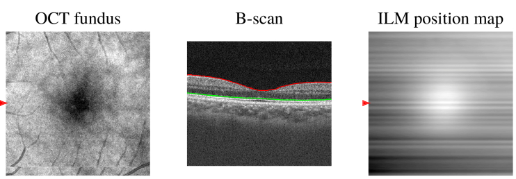 Fig. 6.