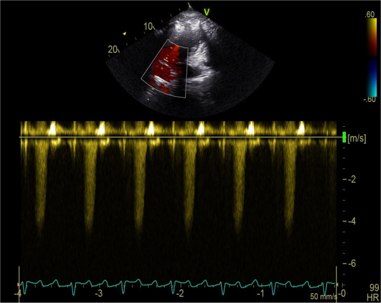 Fig 4