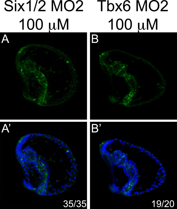 Figure 4—figure supplement 4.