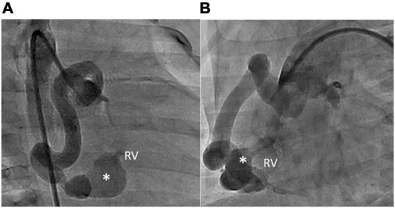 FIGURE 3