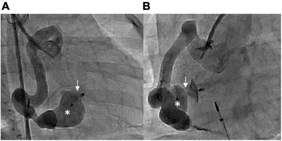 FIGURE 4