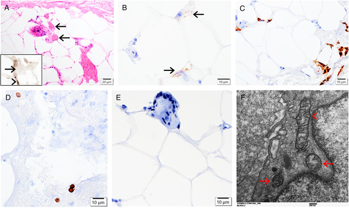 FIGURE 3