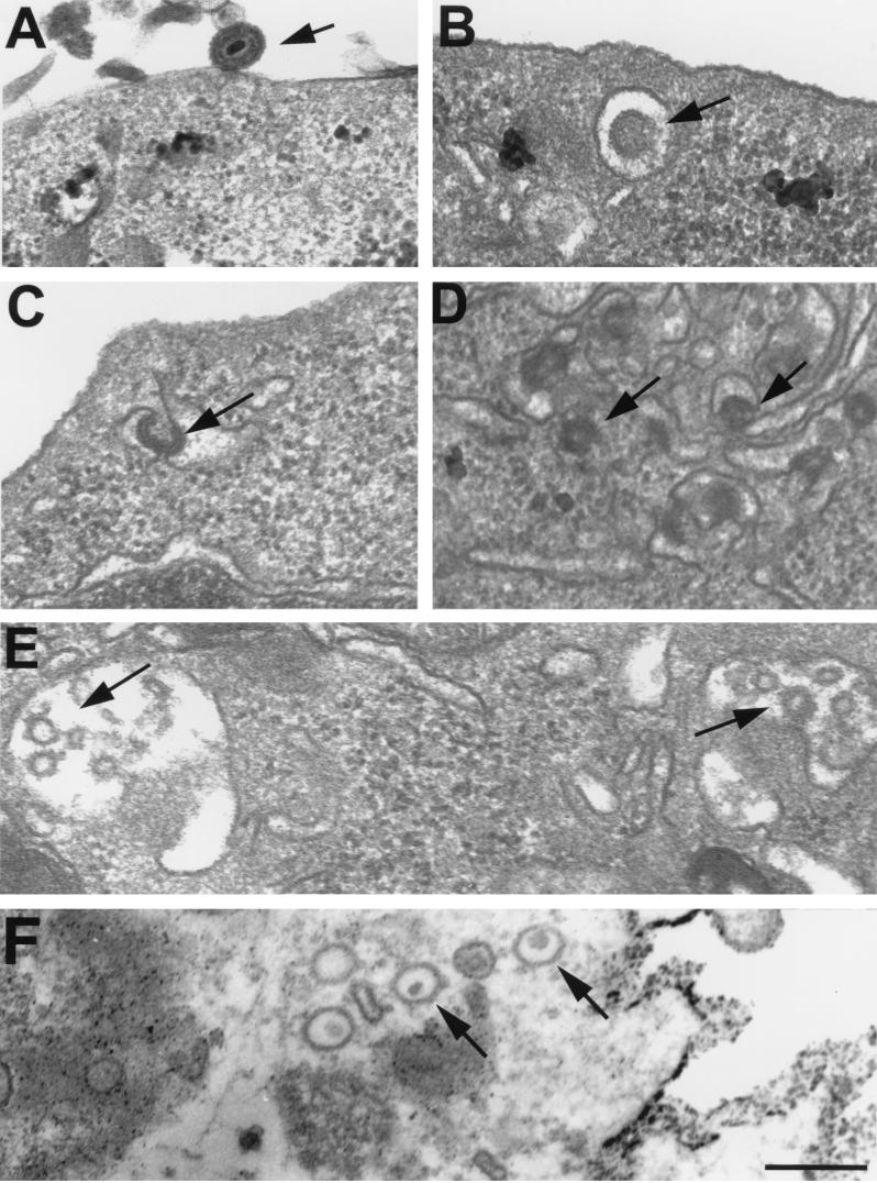 FIG. 12