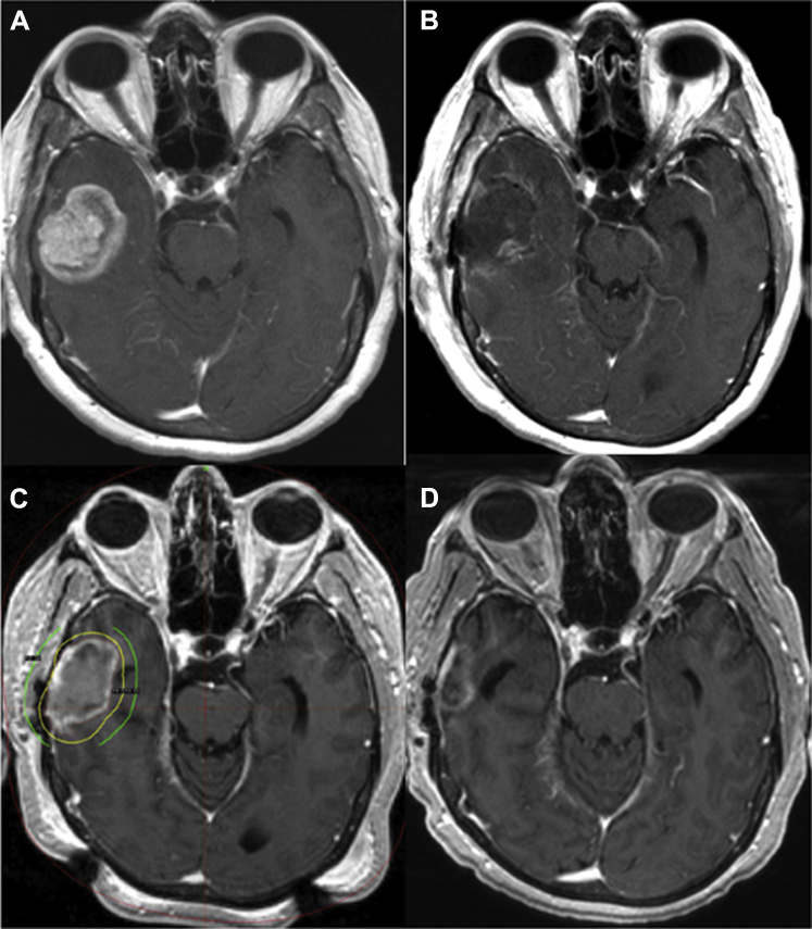 Figure 1