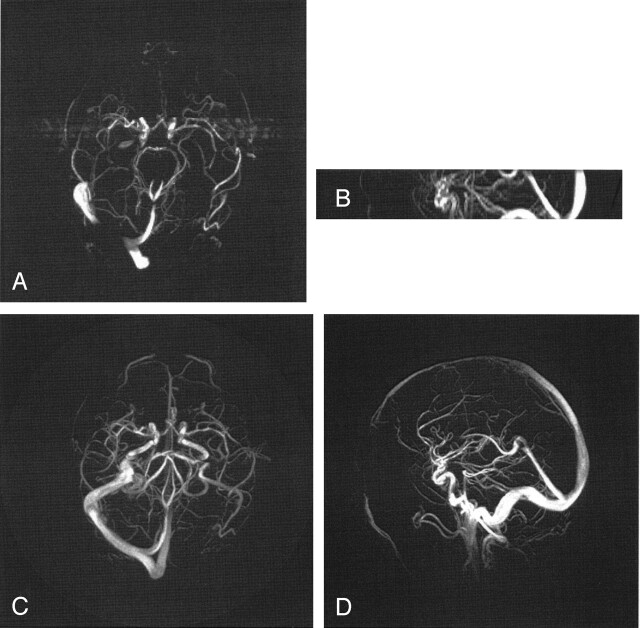 Fig 2.