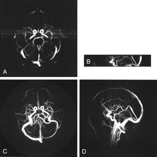 Fig 3.