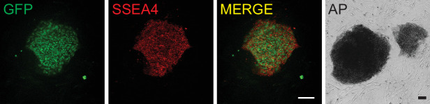 Figure 2—figure supplement 1.