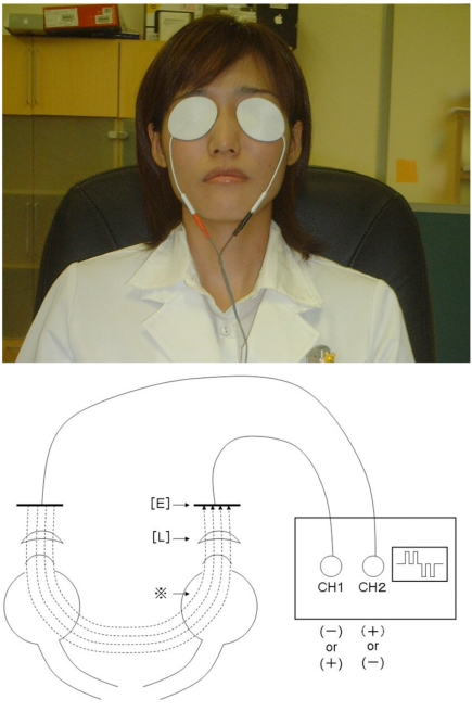 Fig. (1)