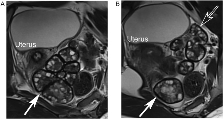 Fig 2 –