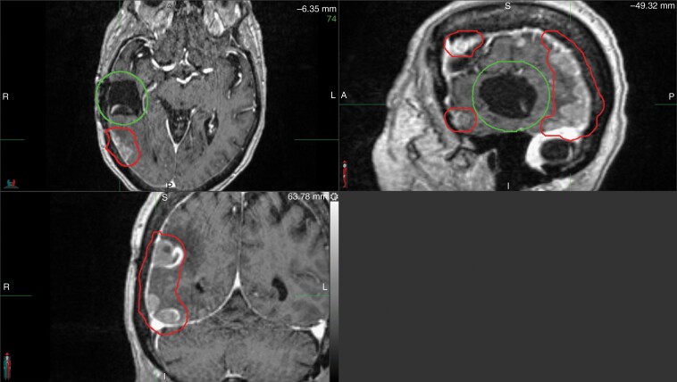 Fig. 6