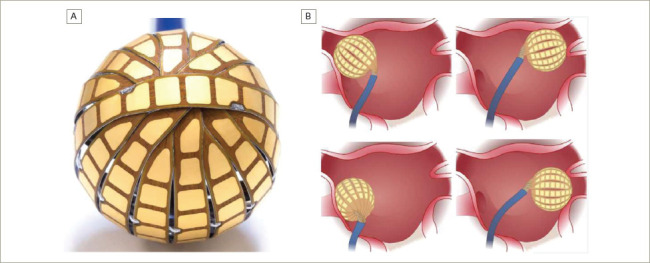 Figure 1: