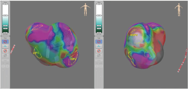 Figure 2: