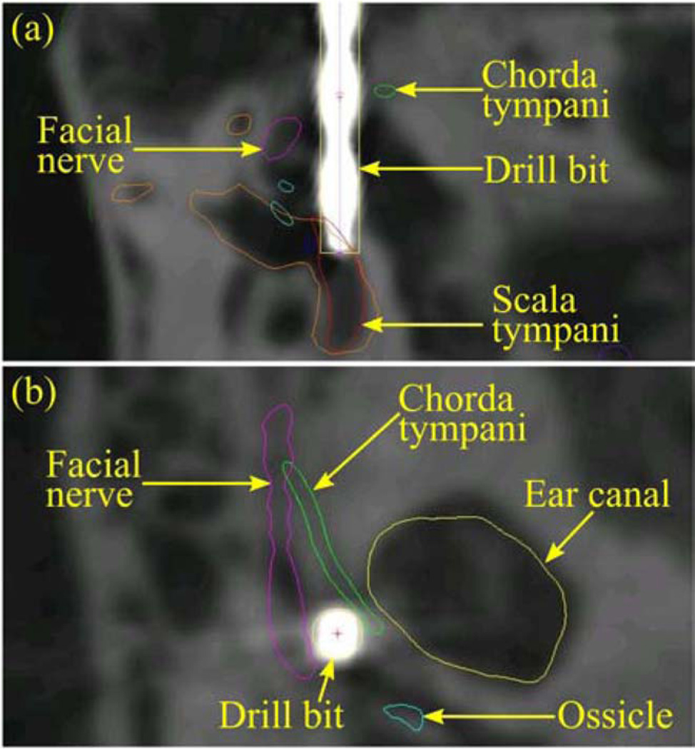 Fig. 11