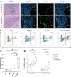 Combination treatment with incomplete cryoablation (iCryo) and matrix
metalloproteinase (MMP) inhibition (MMPI) modulate lymphocyte populations in
the tumor microenvironment. (A) Representative low-magnification
(10×) hematoxylin and eosin (H&E) images show the necrotic
ablation zone (NZ) in Tib-75–induced tumors in BALB/c mice after
treatment with incomplete cryoablation and the vehicle phosphate-buffered
saline (PBS) (top row) and after treatment with incomplete cryoablation and
the MMP inhibitor batimastat (bottom row). Representative images of
immunofluorescence costaining of tumor-infiltrating cytotoxic T cells (CD8+)
(magnification, 20×). DAPI = 4',6-diamidino-2-phenylindole, L
= healthy liver, T = tumor. (B) Representative flow cytometry plots (n = 1)
for CD3 and CD8 coexpression in CD45.2 (hematopoietic) gate show higher
infiltration of CD8+ cells in mice treated with incomplete cryoablation and
the MMP inhibitor relative to no treatment (CTRL), the MMP inhibitor only,
and incomplete cryoablation only. (C) Box and whisker plot shows the average
number of CD8+ cells in five random fields of view (FOVs) from the tumor
center in immunofluorescence images under 20× magnification (n = 6
per group). (D) Box and whisker plot shows the percentage of CD3+/CD4+ T
helper lymphocytes and CD3+/CD8+ cytotoxic lymphocytes in CD45.2 gate as
quantified at flow cytometry (n = 6 per group). Whiskers indicate maximum
and minimum values. Boxes extend from the 25th to 75th percentiles. The line
in the middle of each box is plotted at the median. * = P <
.05 and ** = P < .01, according to a Kruskal-Wallis
test with Dunn correction for multiple comparisons.