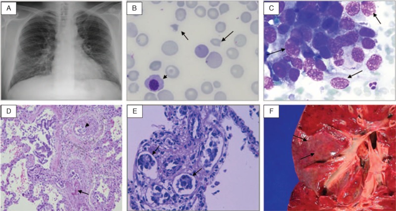 FIGURE 1