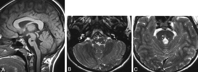 Fig 1.