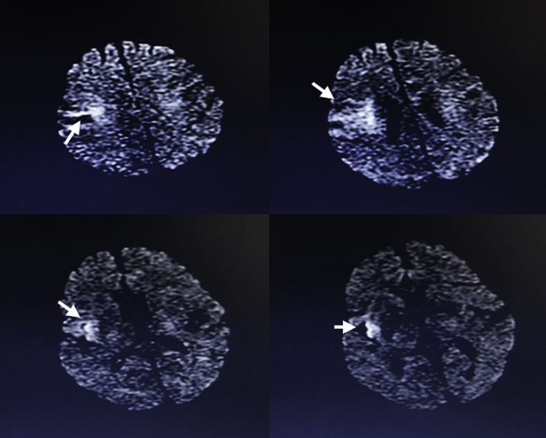 Fig. 2