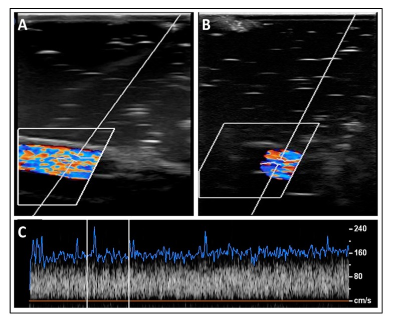 Figure 11