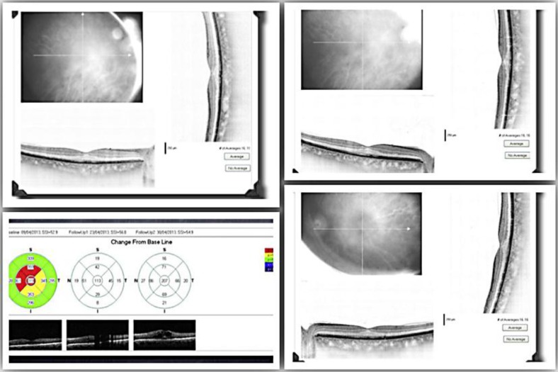 Fig. 3