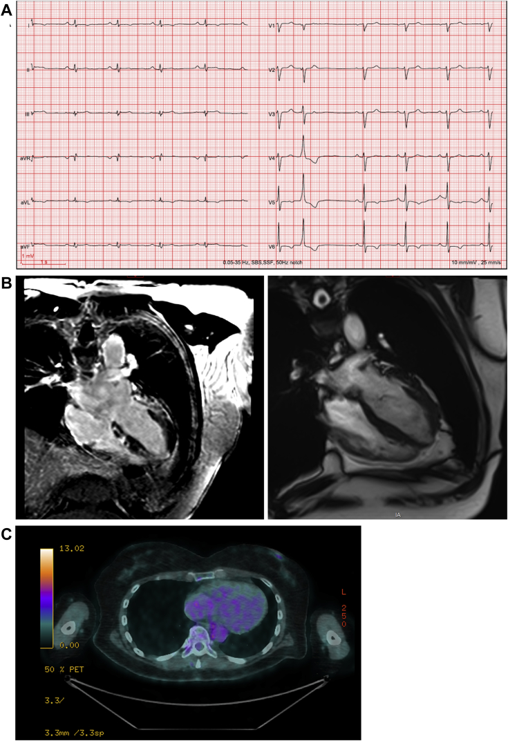 Figure 2