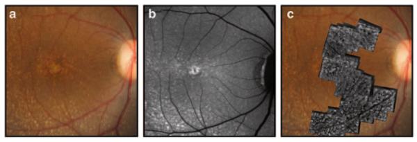 Fig. 39.1