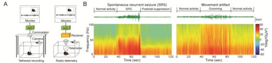 A: Schematic of video-EEG recording of mouse using tethered (Left panel) or radio telemetry (right panel) system; B: Representative EEG trace (top panel) and spectrogram (bottom panel) of SRS and movement artifact.