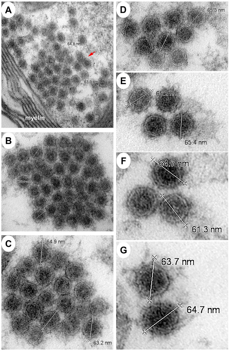 Fig 14