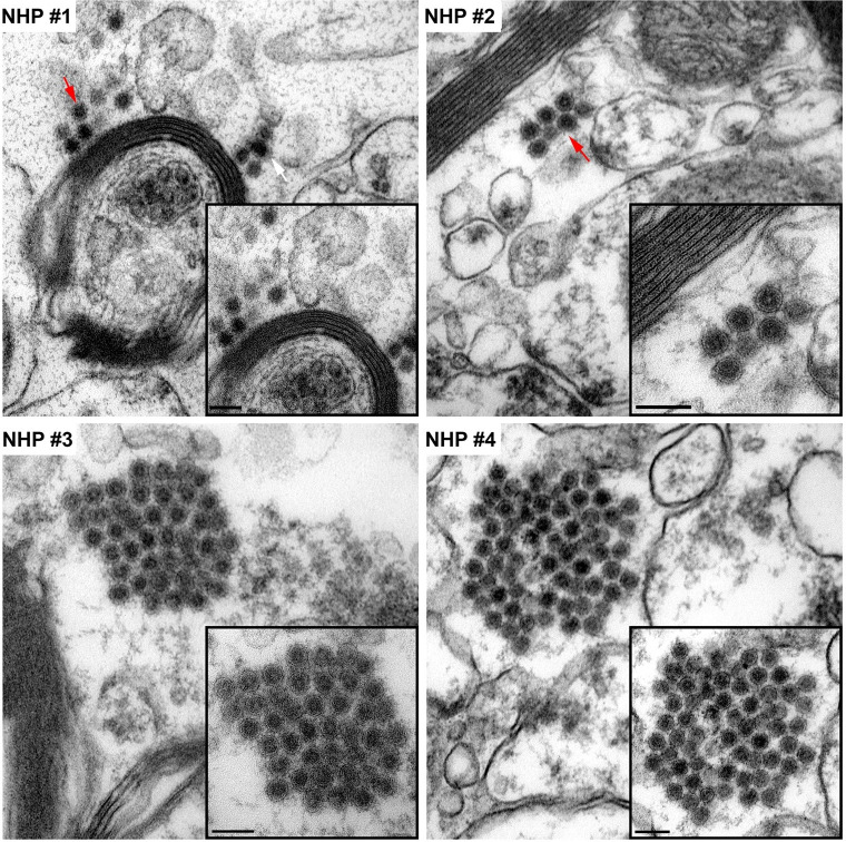 Fig 13