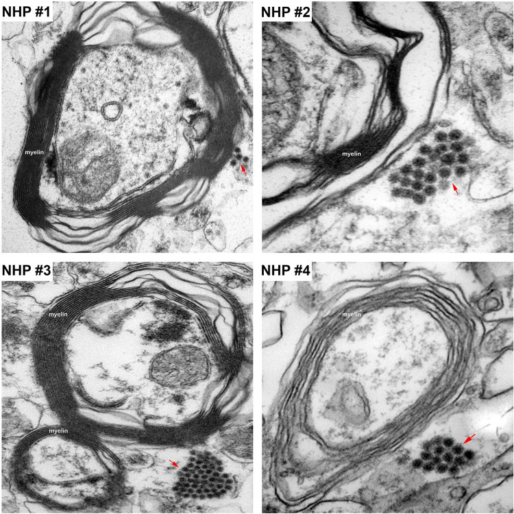 Fig 15