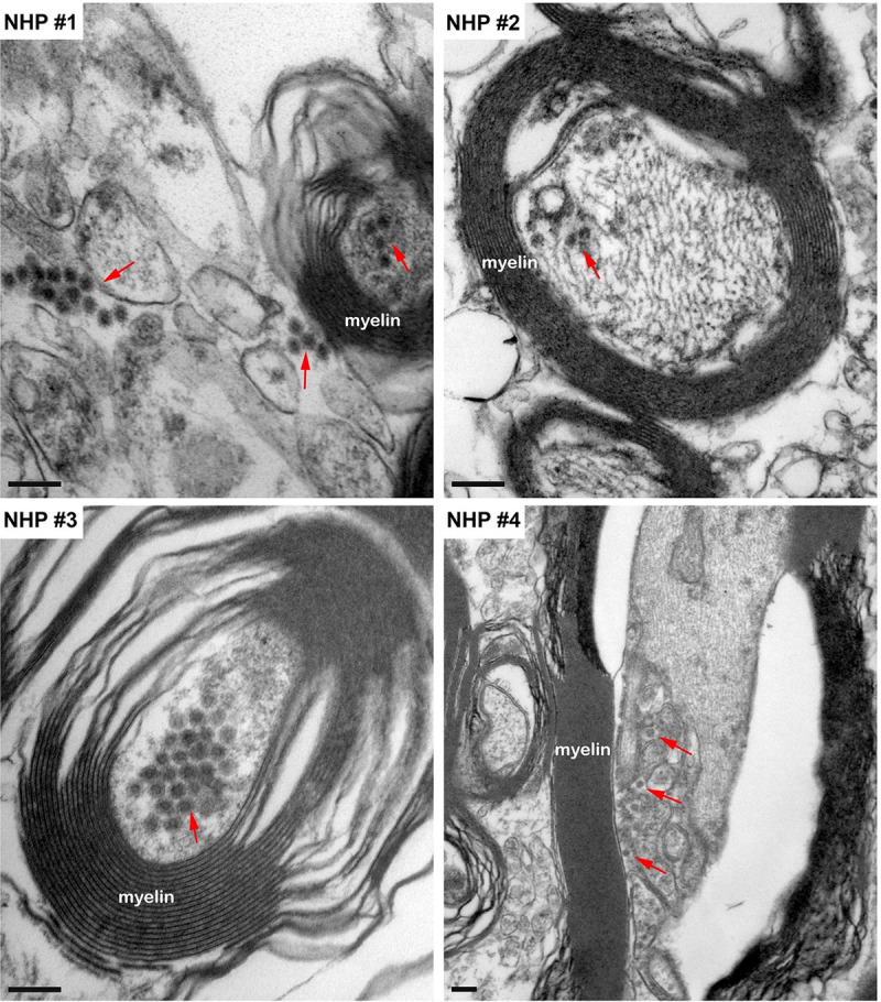 Fig 16